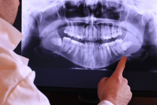 Best Emergency Gum Treatment in Redmond, OR