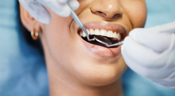 Best Urgent Care for Lost Fillings or Crowns in Redmond, OR